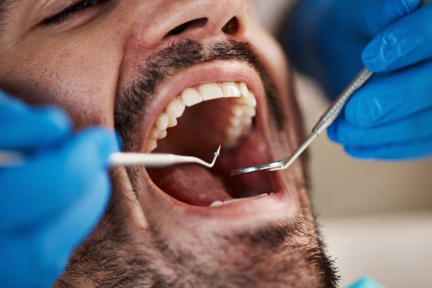 Best Weekend Emergency Dentist in Columbus, OH